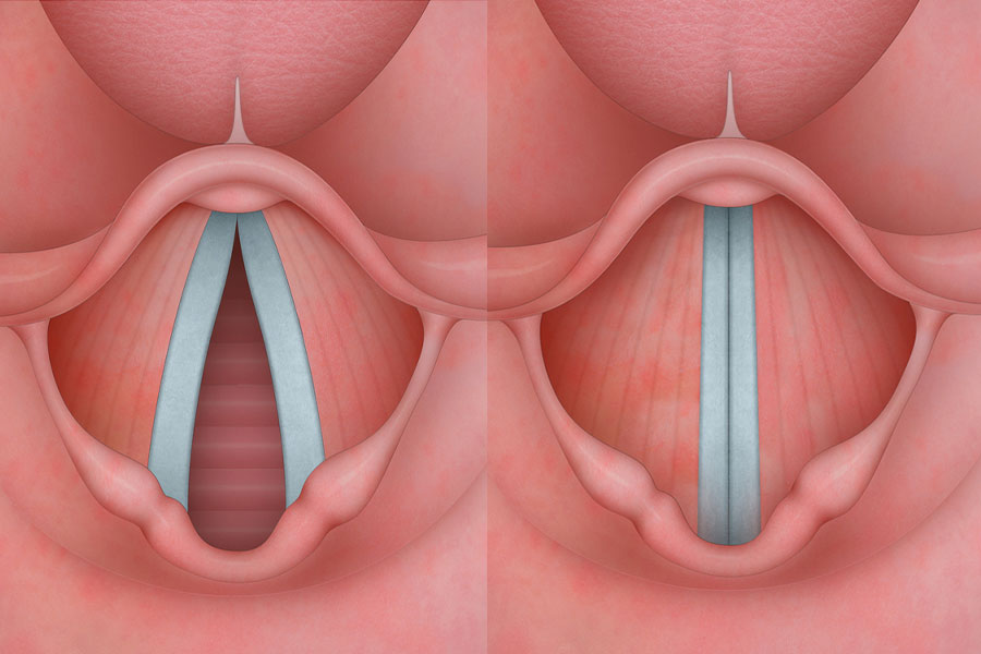 CuerdasVocales CUERPOTEXTO