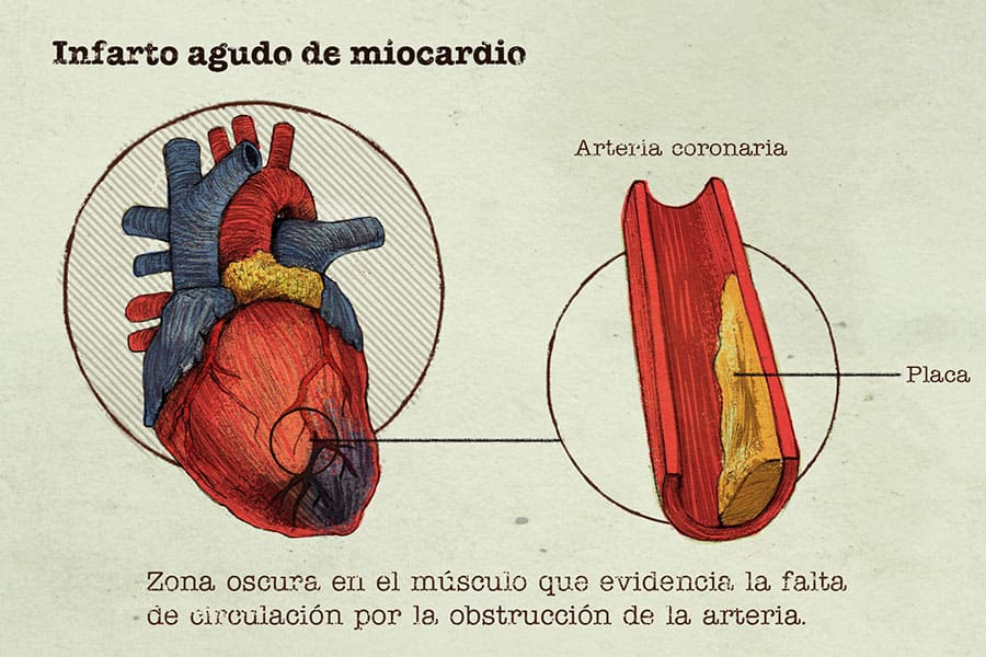 GlosarioCorazón3 CUERPOTEXTO