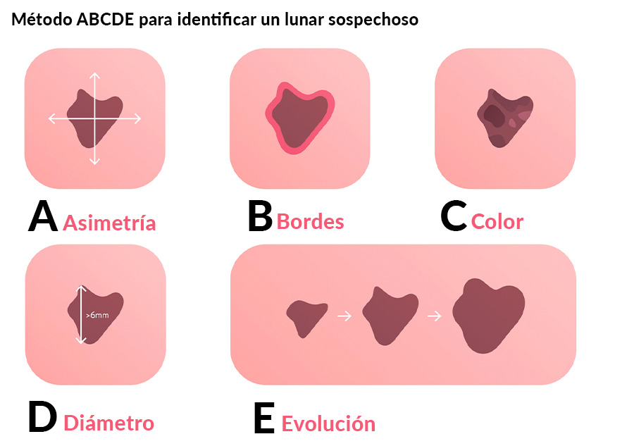 LUNARES CUERPOTEXTO2