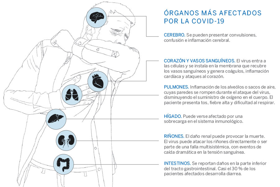 Coronavirus: ¿un electroestimulador puede realmente ponerme en forma  durante la cuarentena?