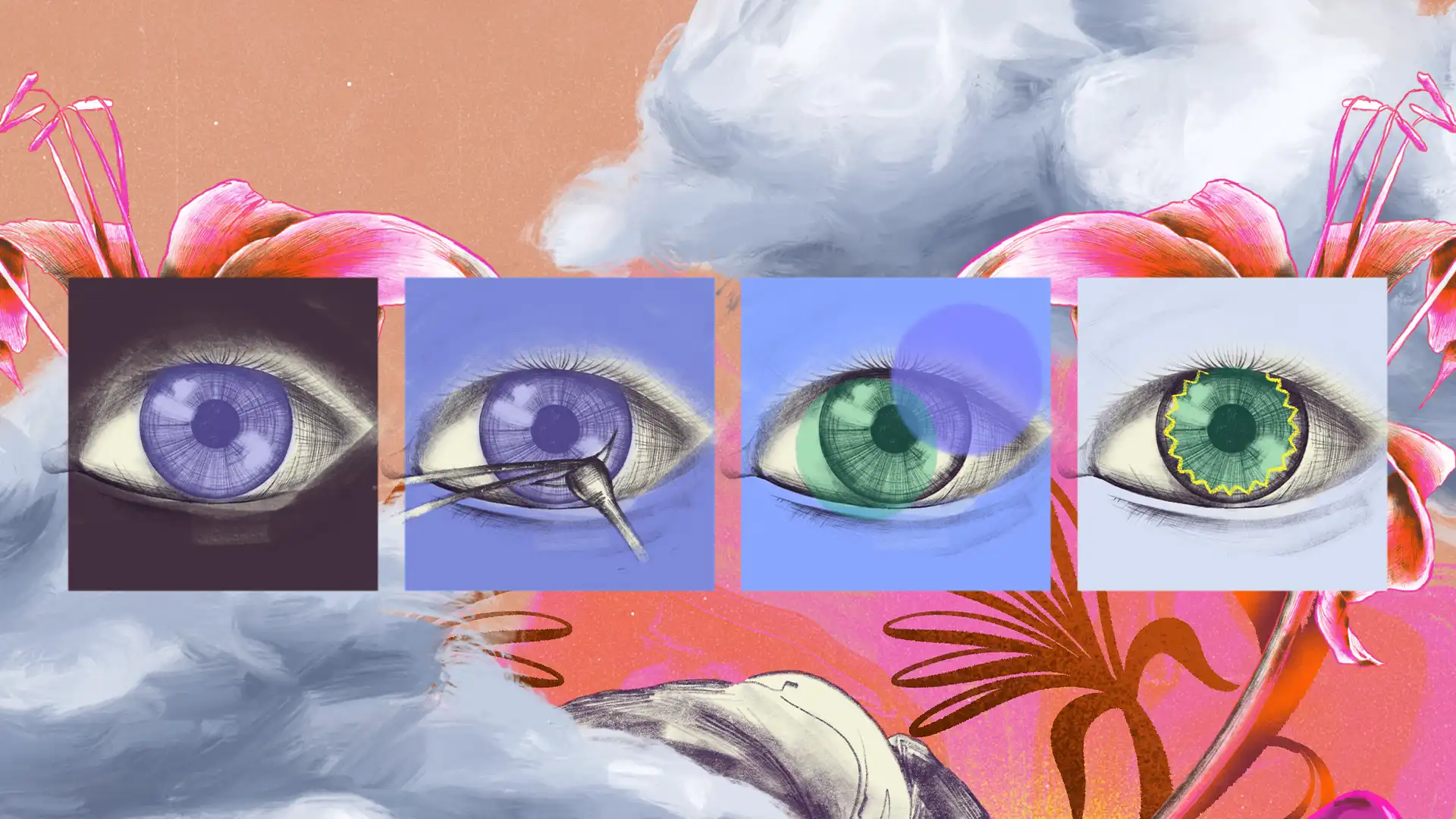 Trasplante de córnea