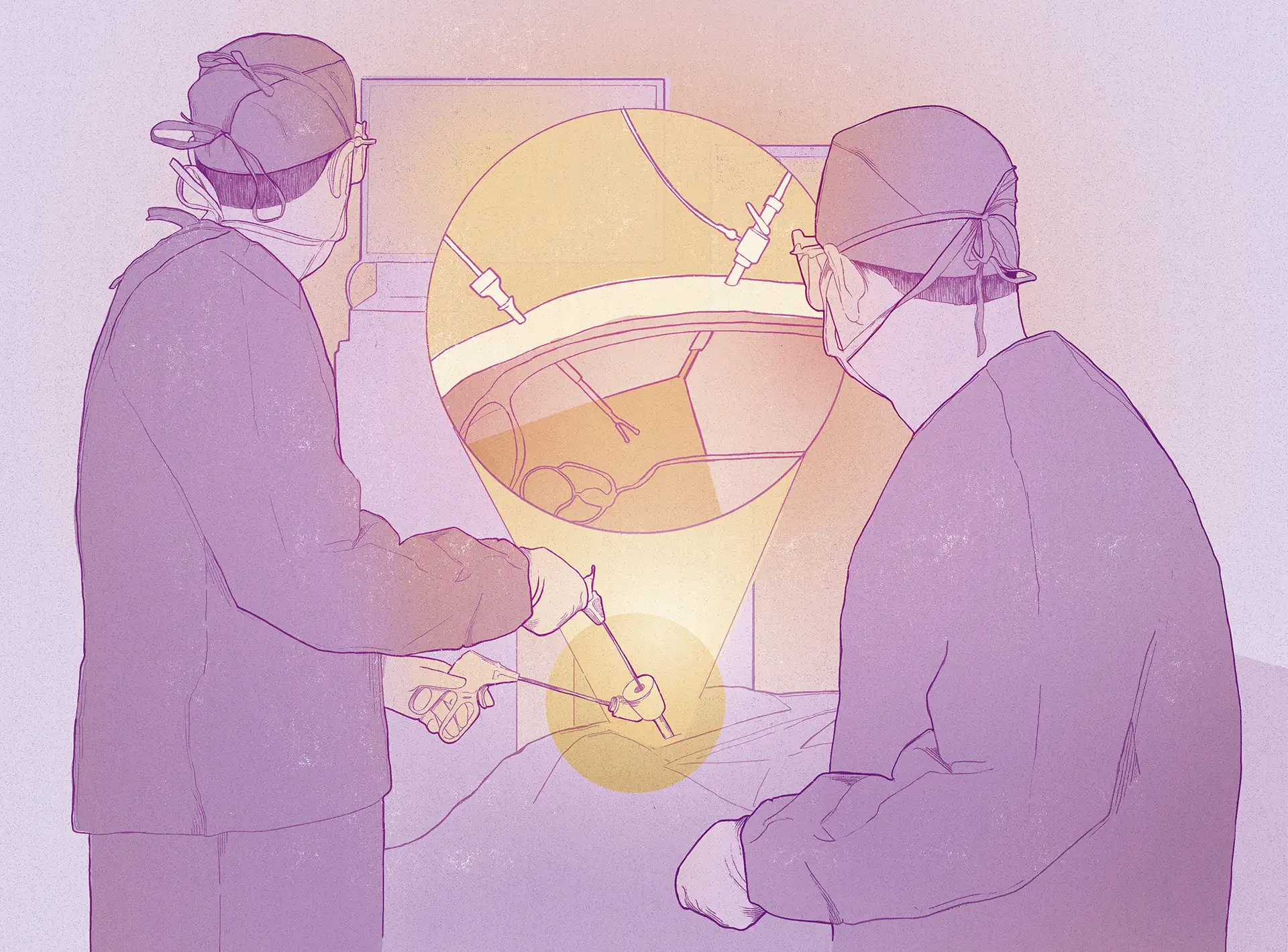 Cirugía laparoscópica