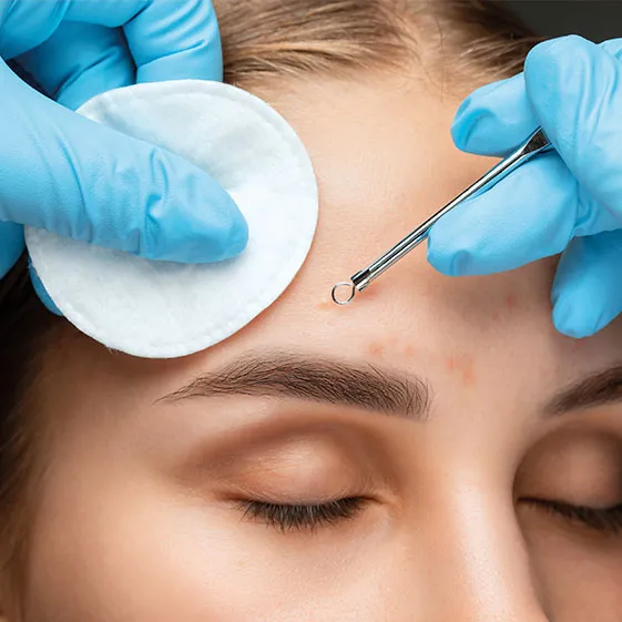 Los beneficios de la limpieza facial profunda