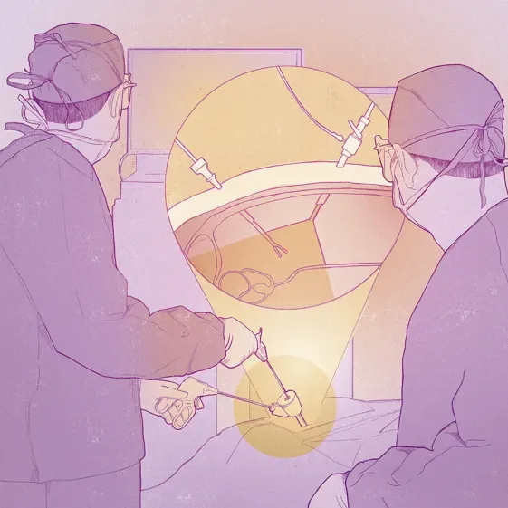 Cirugía laparoscópica