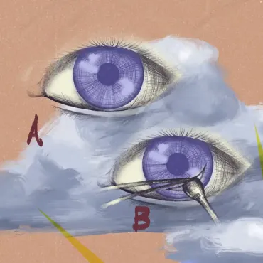 Trasplante de córnea