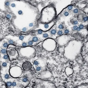 hantavirus