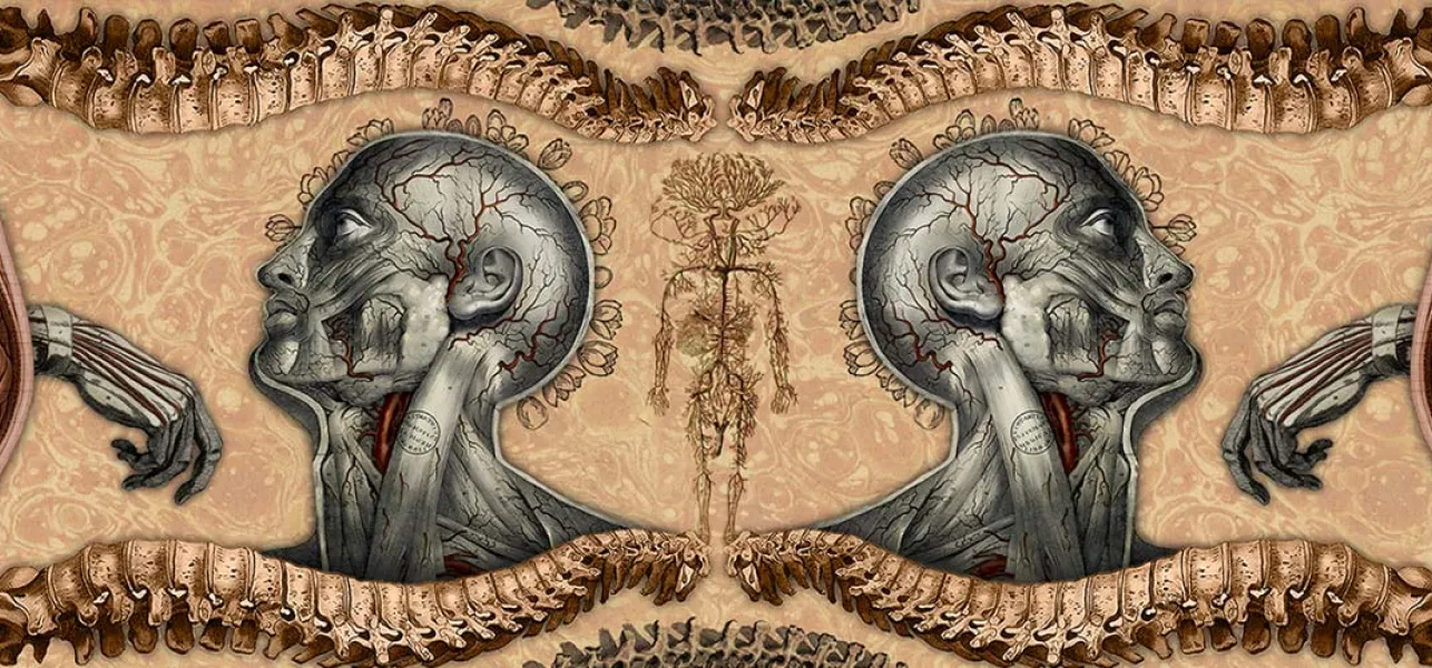 Síndrome de Guillain-Barré