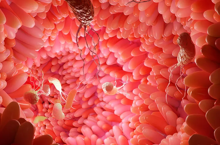 gastritis