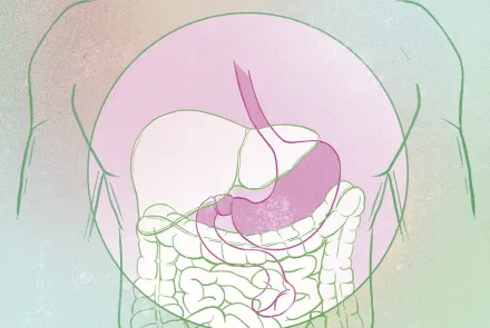 cirugía bariátrica