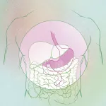 cirugía bariátrica