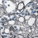 hantavirus
